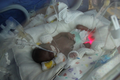 出産当日その2 妊娠23週0日 あっくんのnicu Gcu記録 586gで産まれました